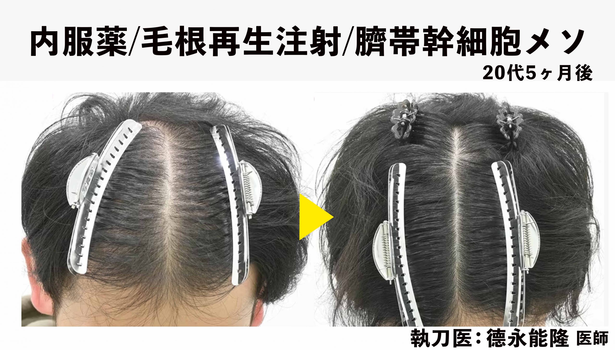  期待できる効果