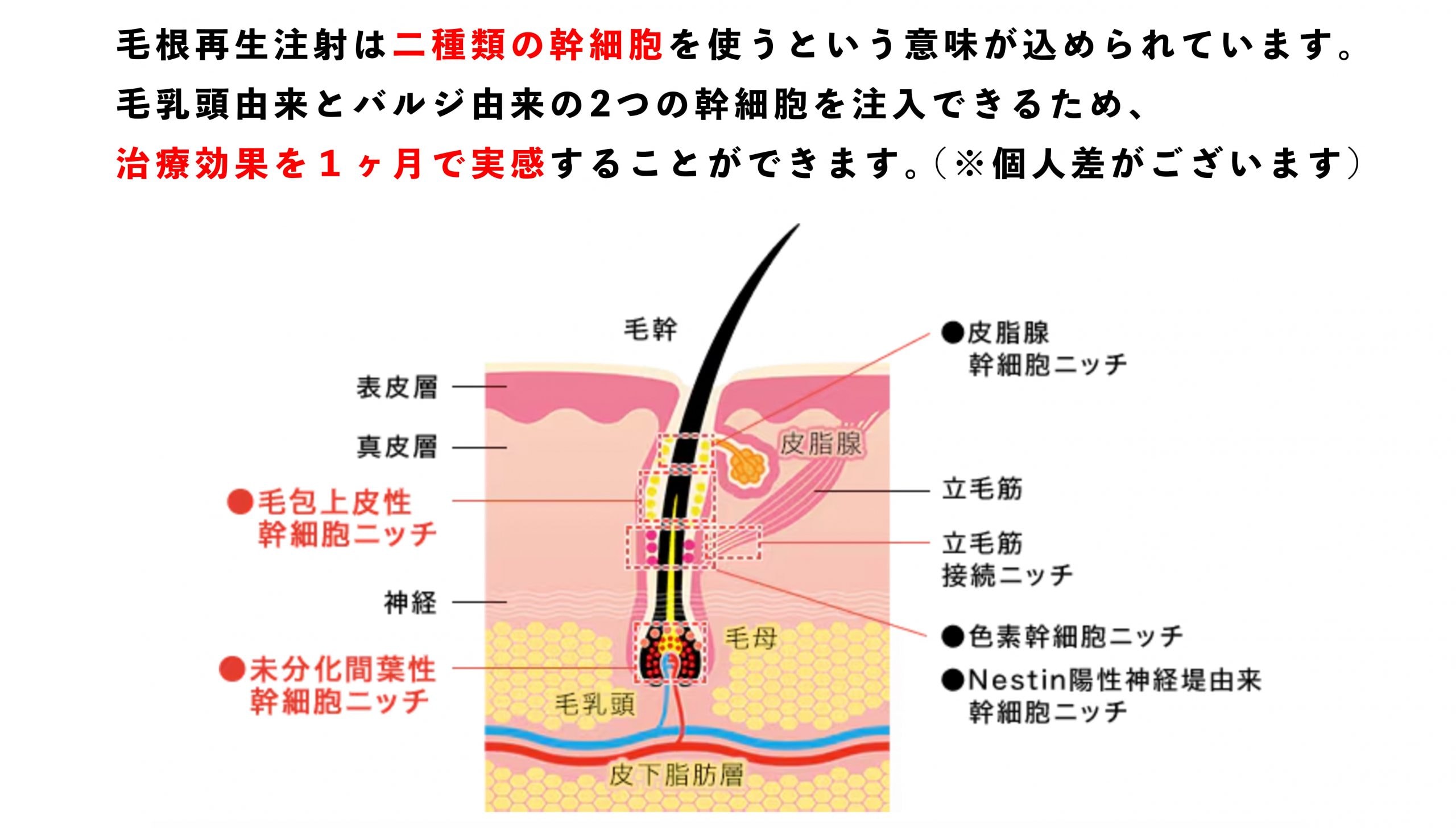 毛根再生注射とは？