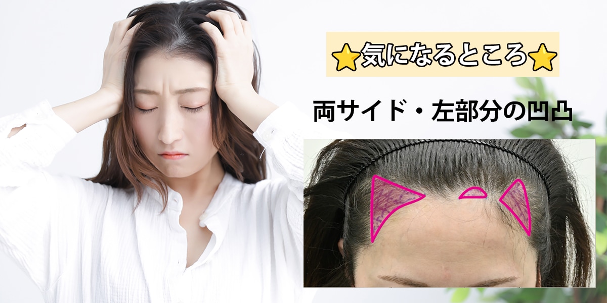 患者情報と悩み