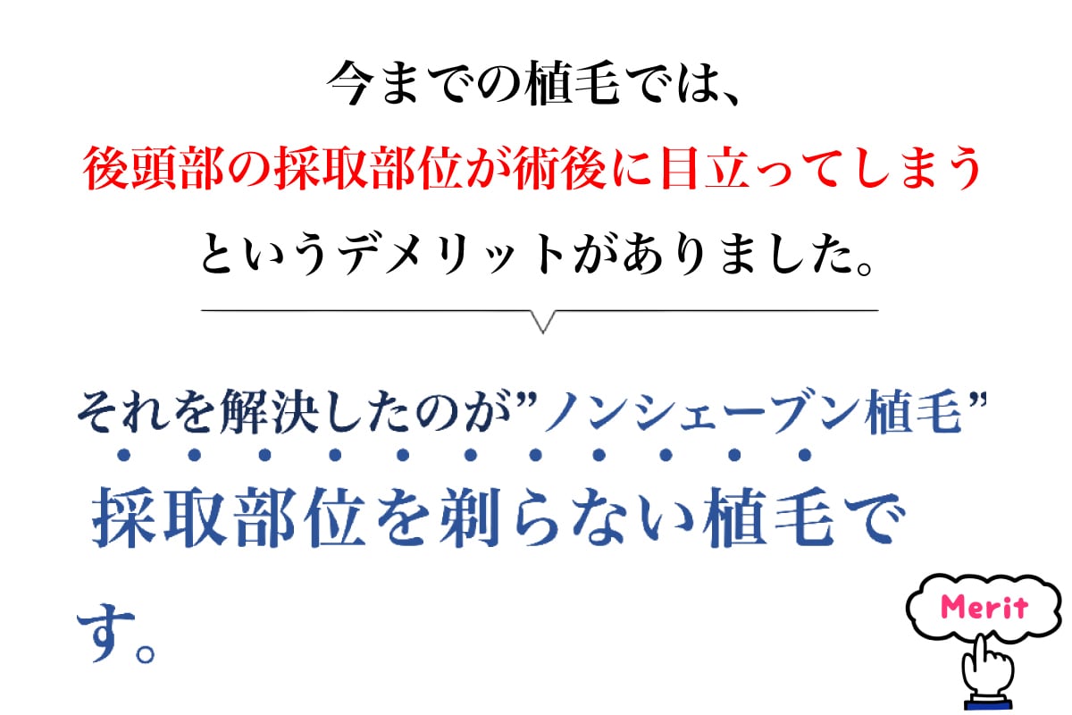 ノンシェーブン植毛の特徴