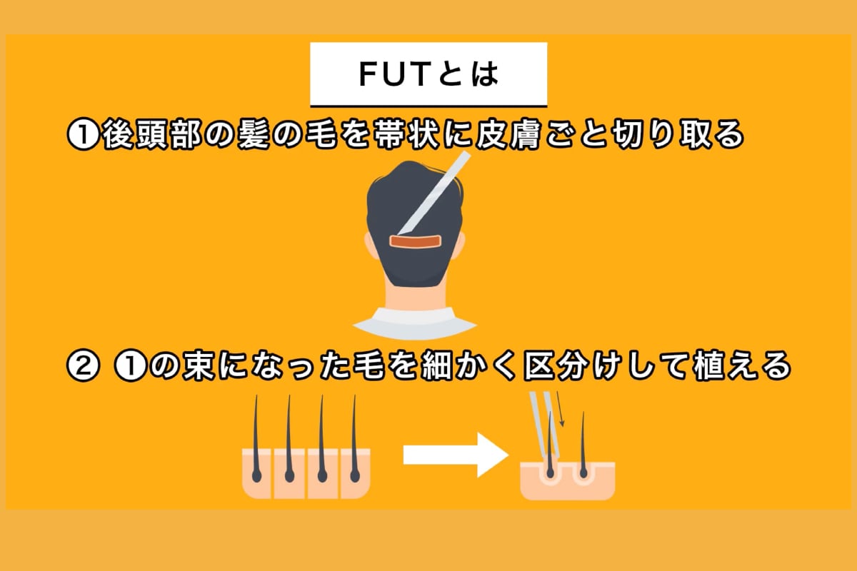 過去の手術とその結果