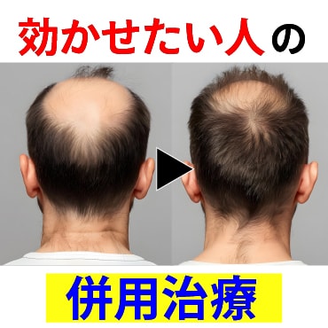 【速報】“臍帯メソ”とFolixが同日併用できるようになりました✨-湘南AGAクリニック広島院-