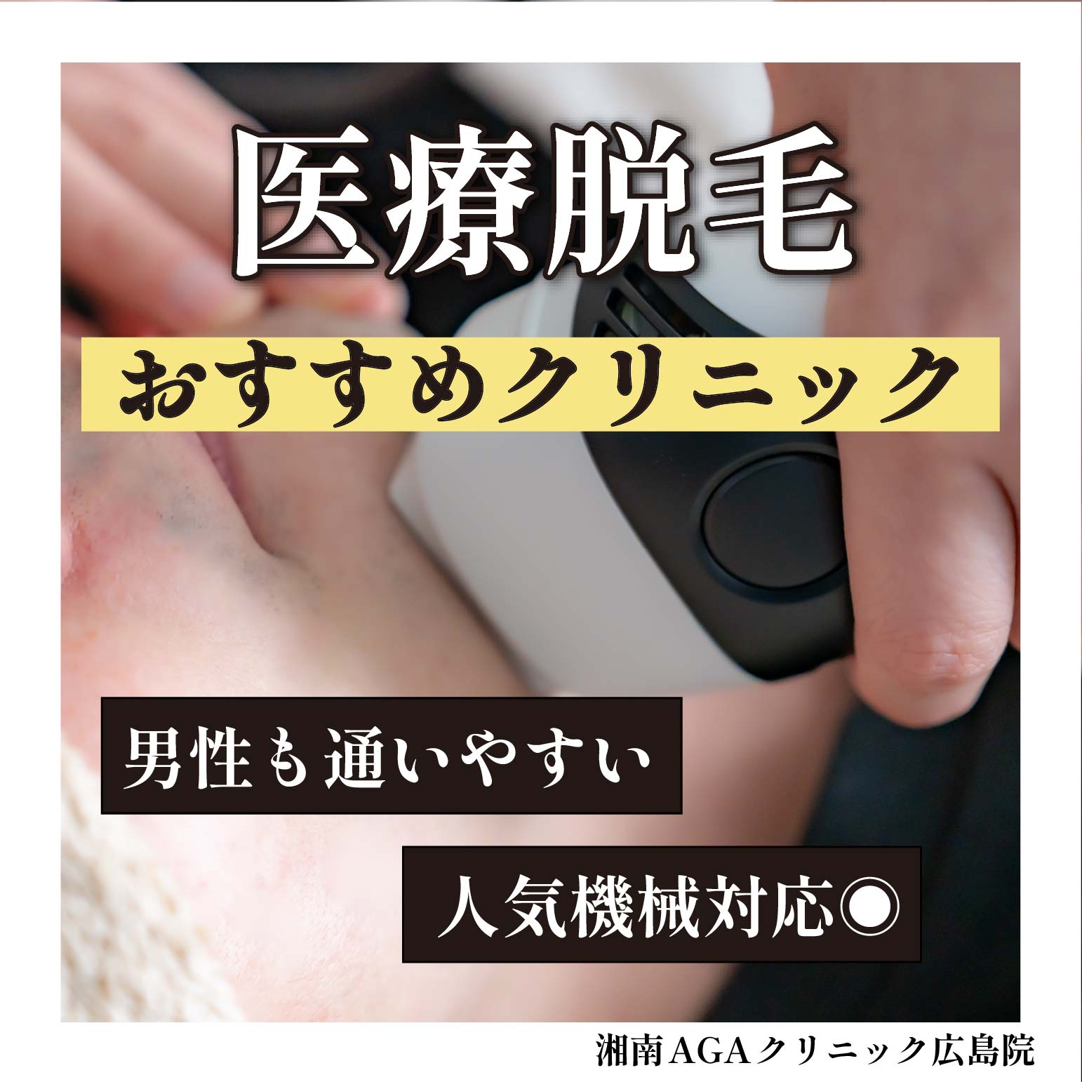 【保存版】広島で医療脱毛するなら湘南AGAクリニック広島院が正解！選ばれる5つの理由を徹底解説