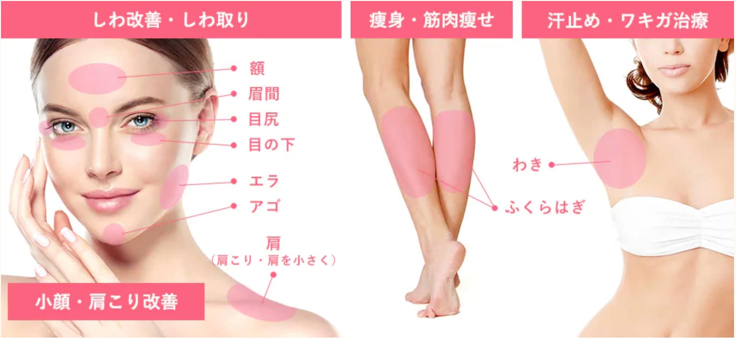 4. 湘南AGAクリニック広島院対応部位