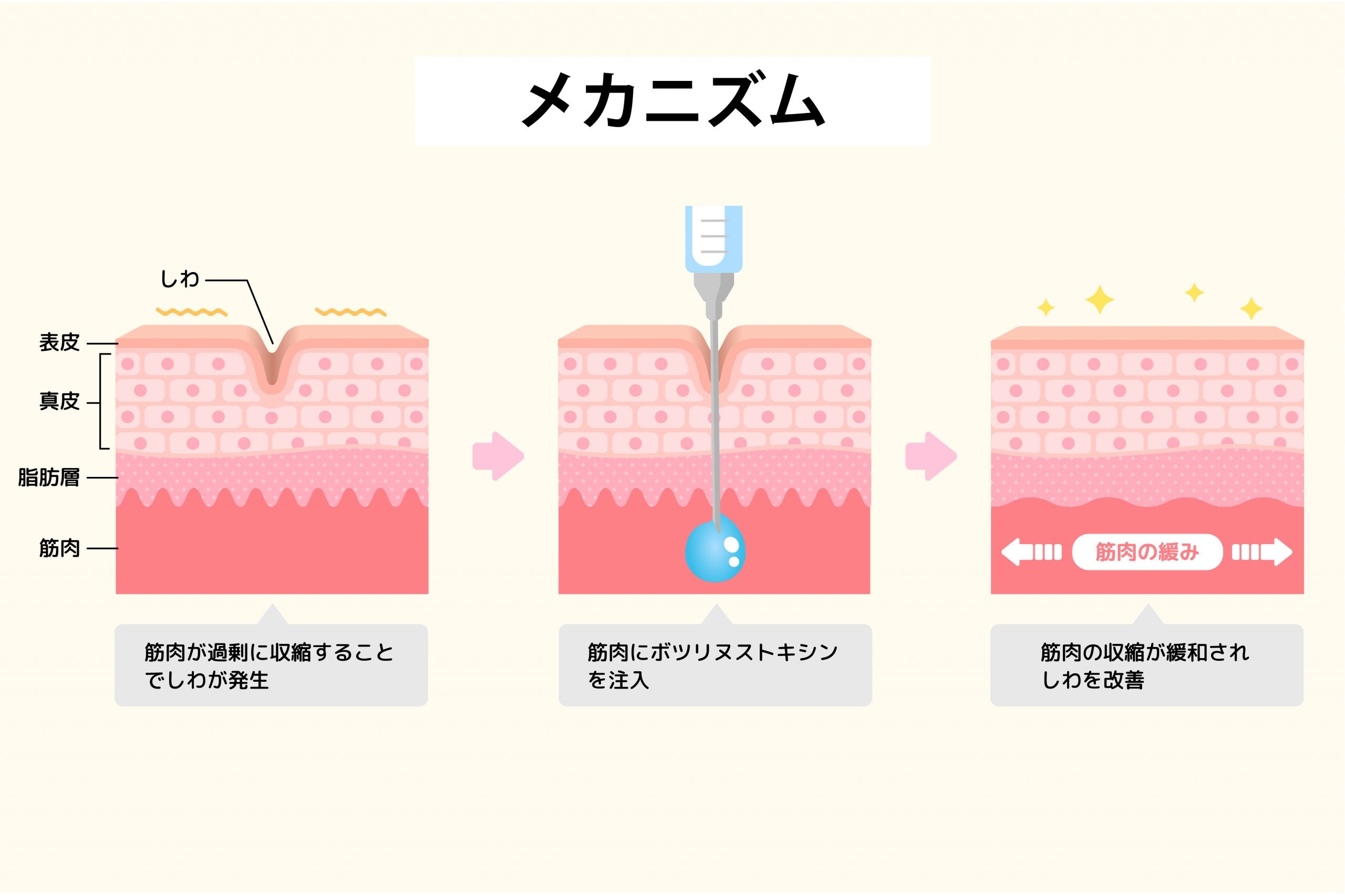 1. 韓国製ボツリヌストキシンとは？その安全性とメカニズム