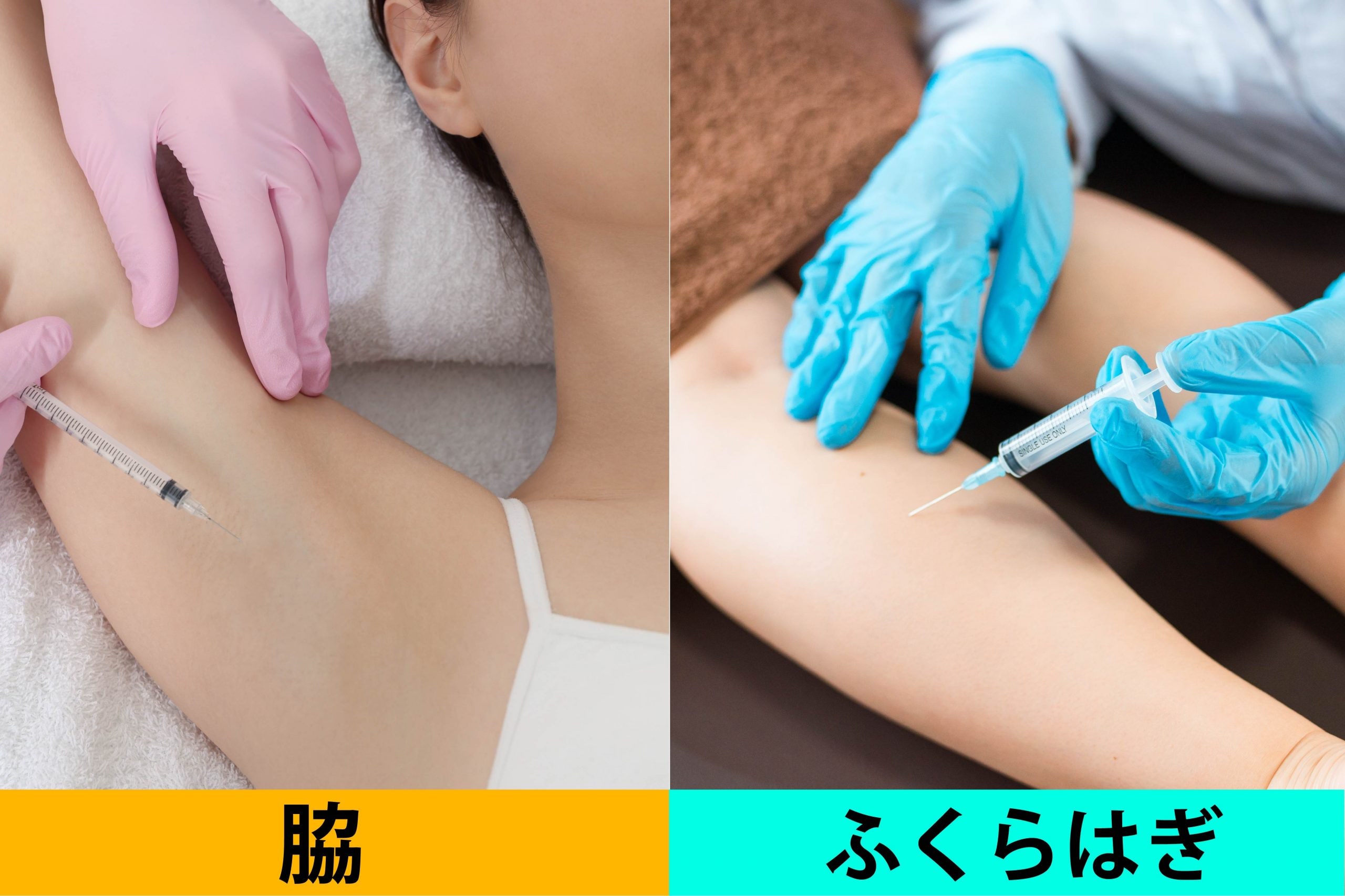 3. 【夏に大人気！】ワキ汗・ワキガ治療とふくらはぎのボリュームダウン