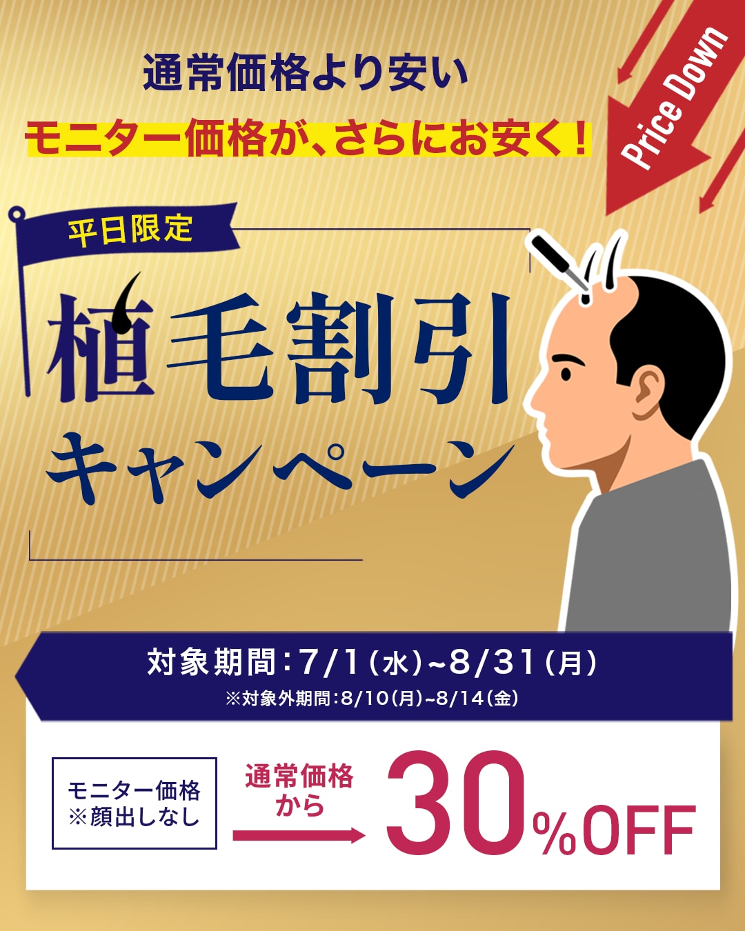 【自毛植毛30%OFF】平日限定でお得に自毛植毛受けれます！-湘南AGAクリニック広島院-