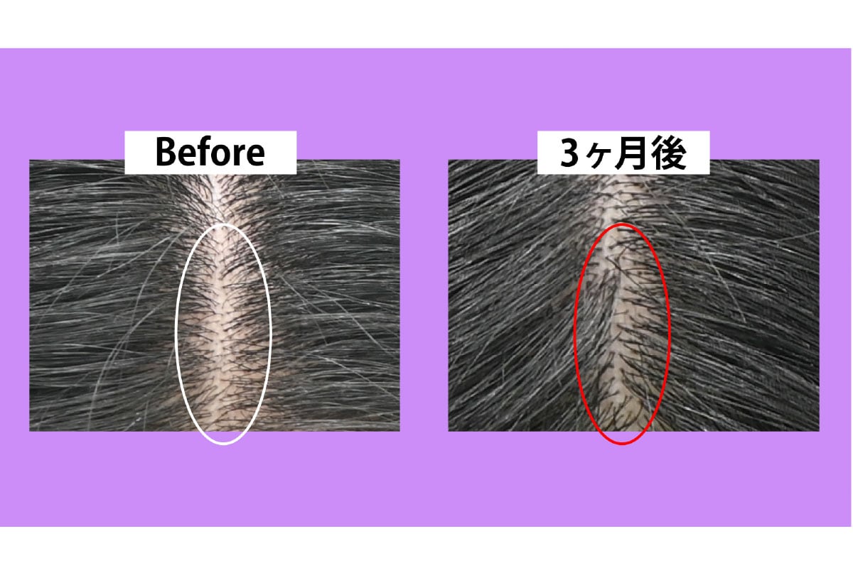 拡大写真で見えてくる「髪の粒」の成長