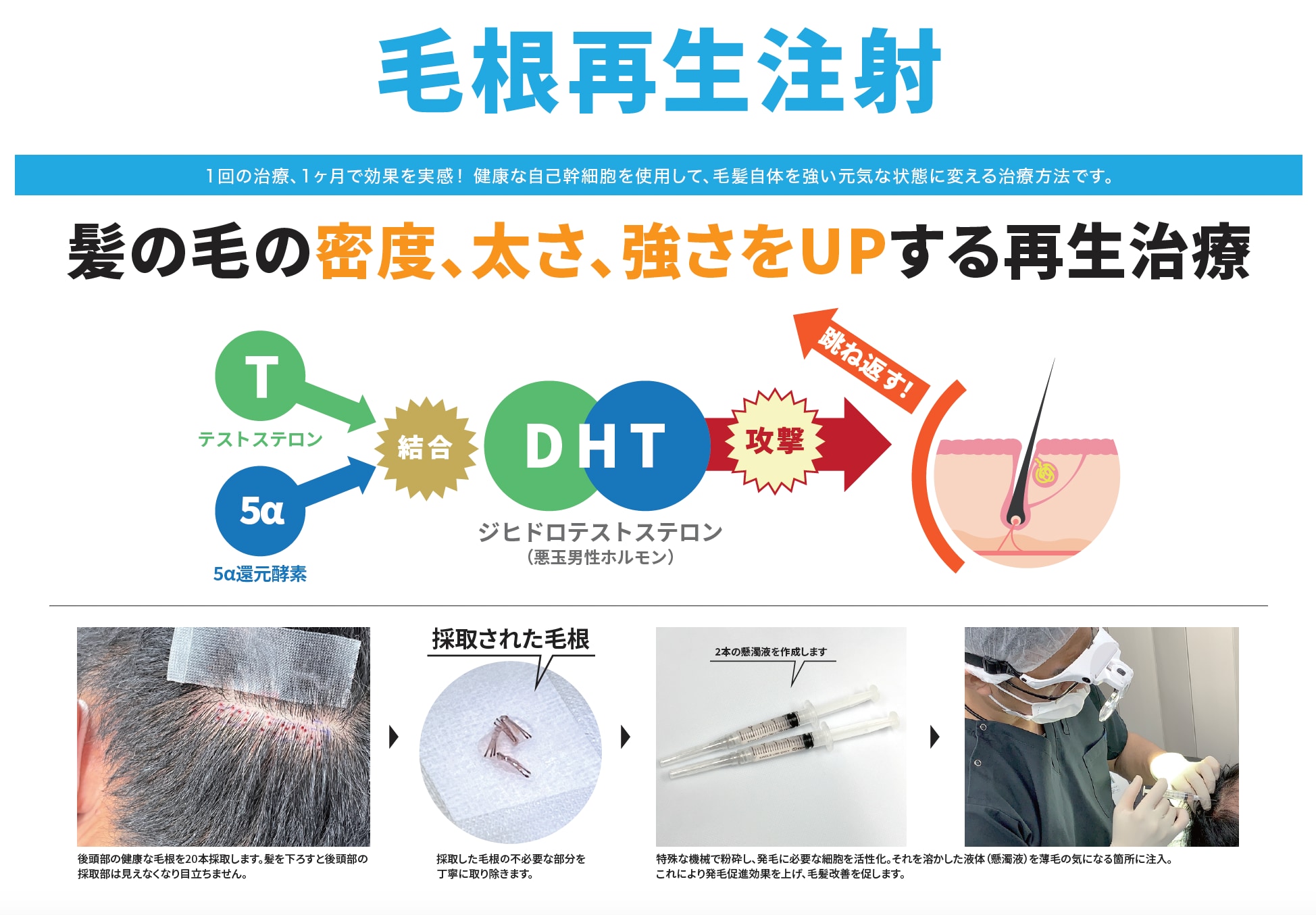毛根が死滅した状態とは?もう生えてこないのか? - 湘南AGAクリニック池袋院-AGA治療・薄毛治療