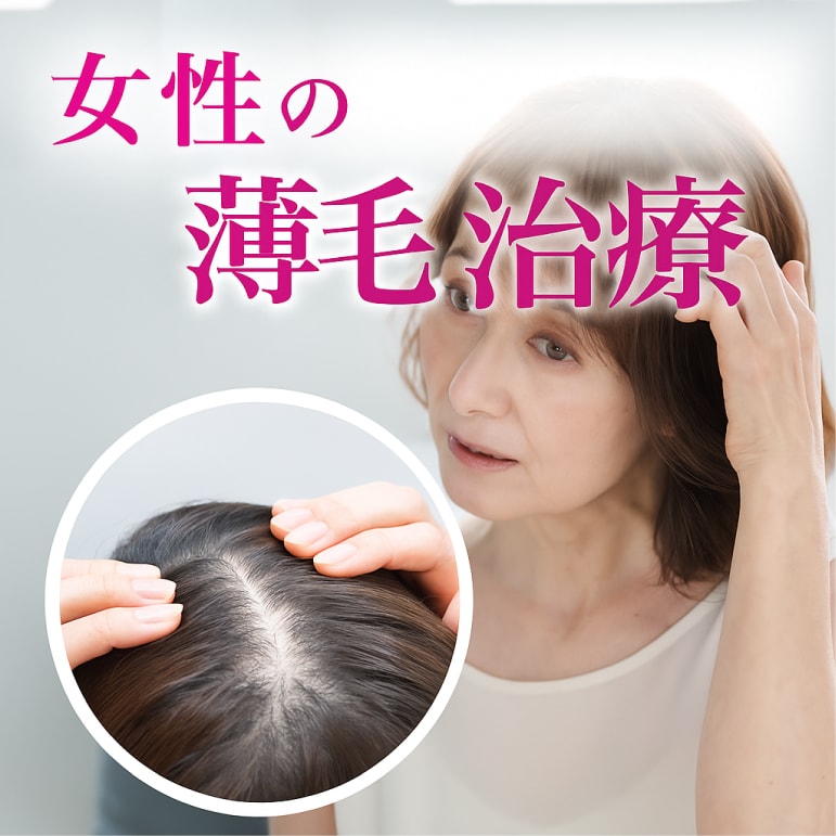女性の薄毛治療（FAGA）｜池袋院で分け目・頭頂部の薄毛改善