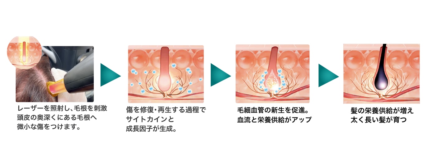 治療のメカニズム