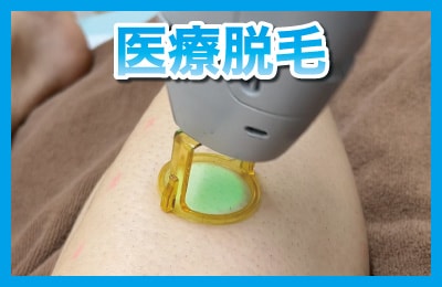 メンズ脱毛も今は当たり前の時代！全身ツルスベ肌へ！