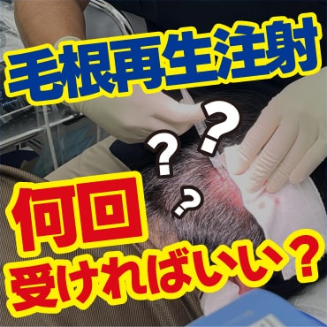 毛根再生注射って何回受ければいいの？