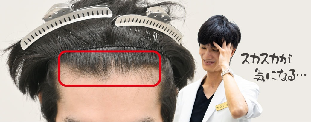 進行していたM字…