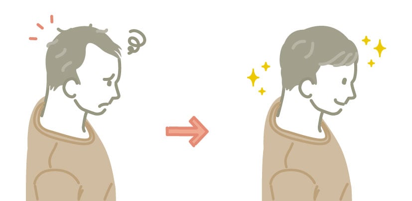 AGA治療内服薬＋αの治療