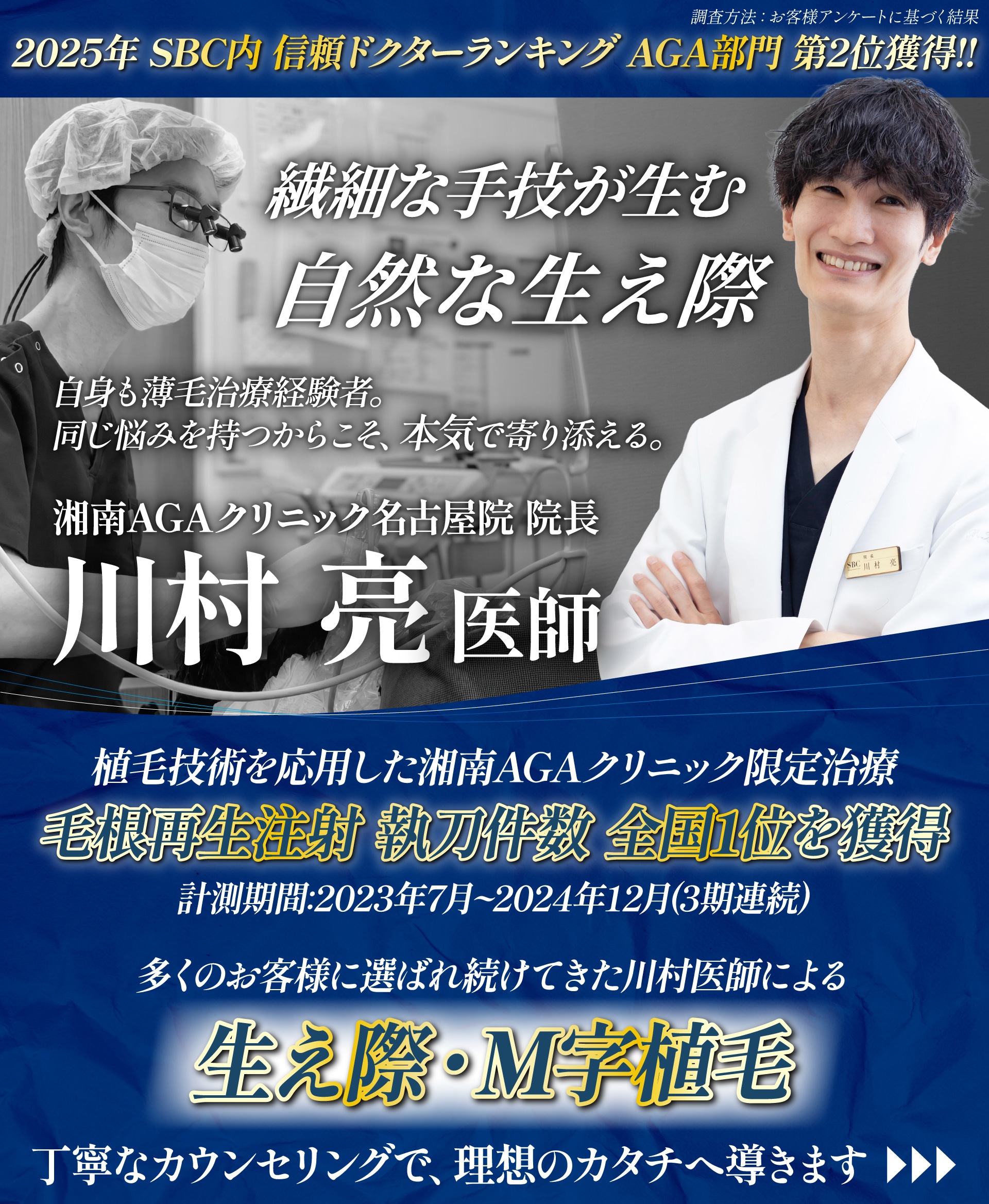“生え際M字”