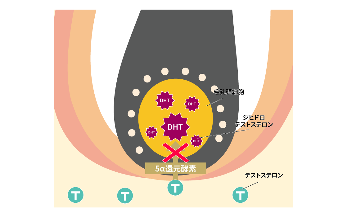 どちらも「5αリダクターゼ阻害薬」