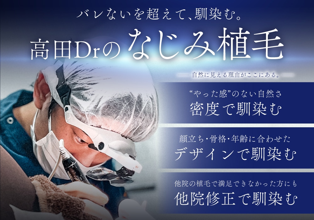 自毛植毛するなら高田医師