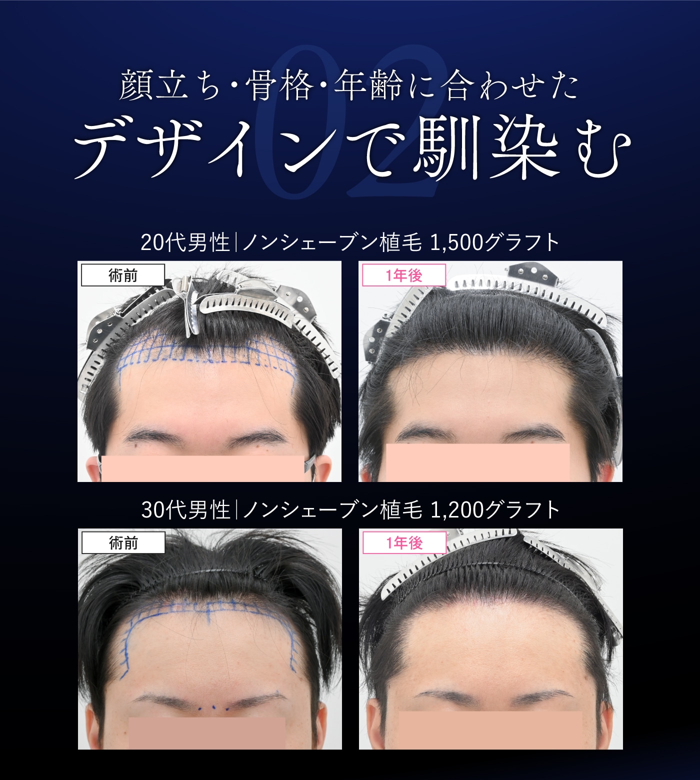 デザインで馴染む