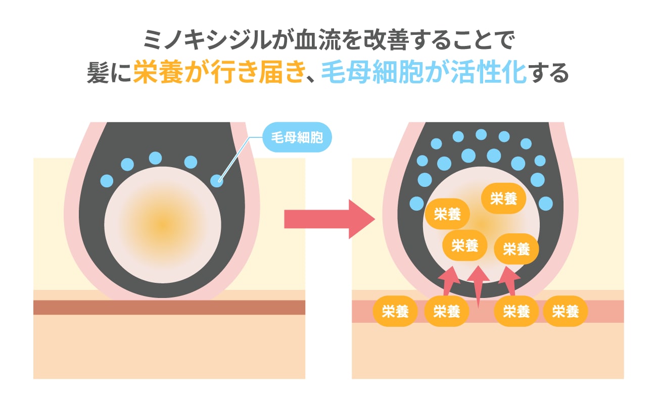 過度な期待は危険