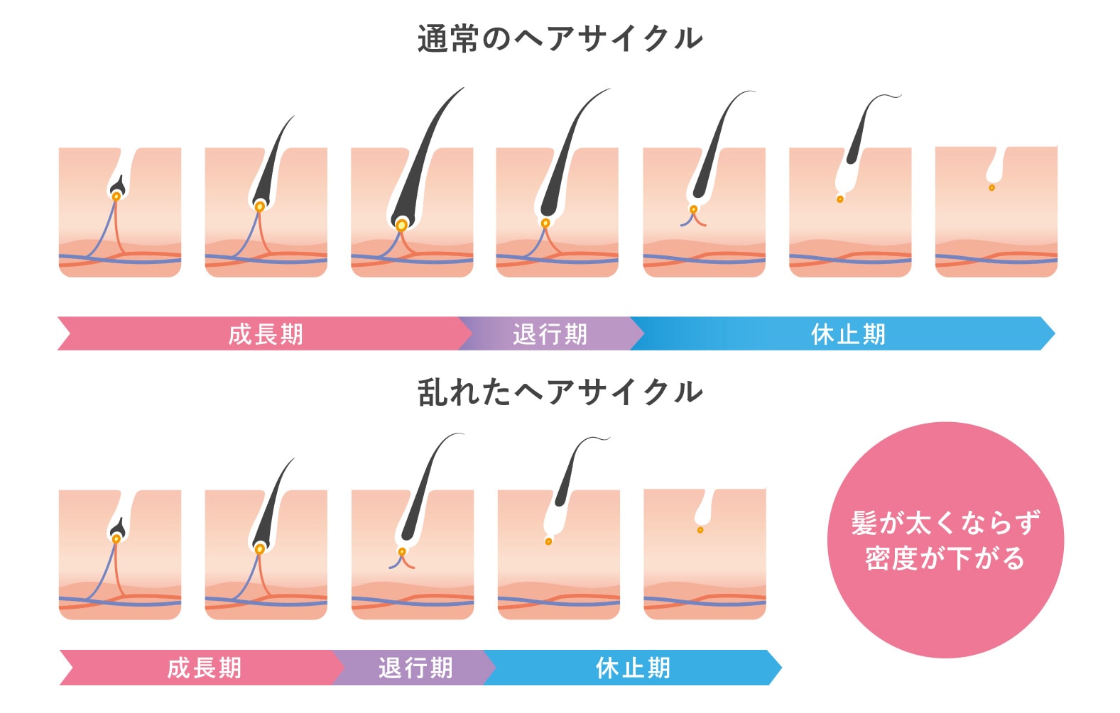 ヘアサイクルの乱れ
