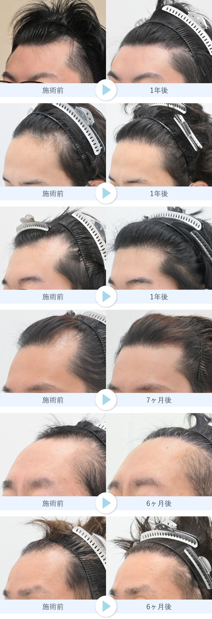 あなたに合わせたデザインをご提案