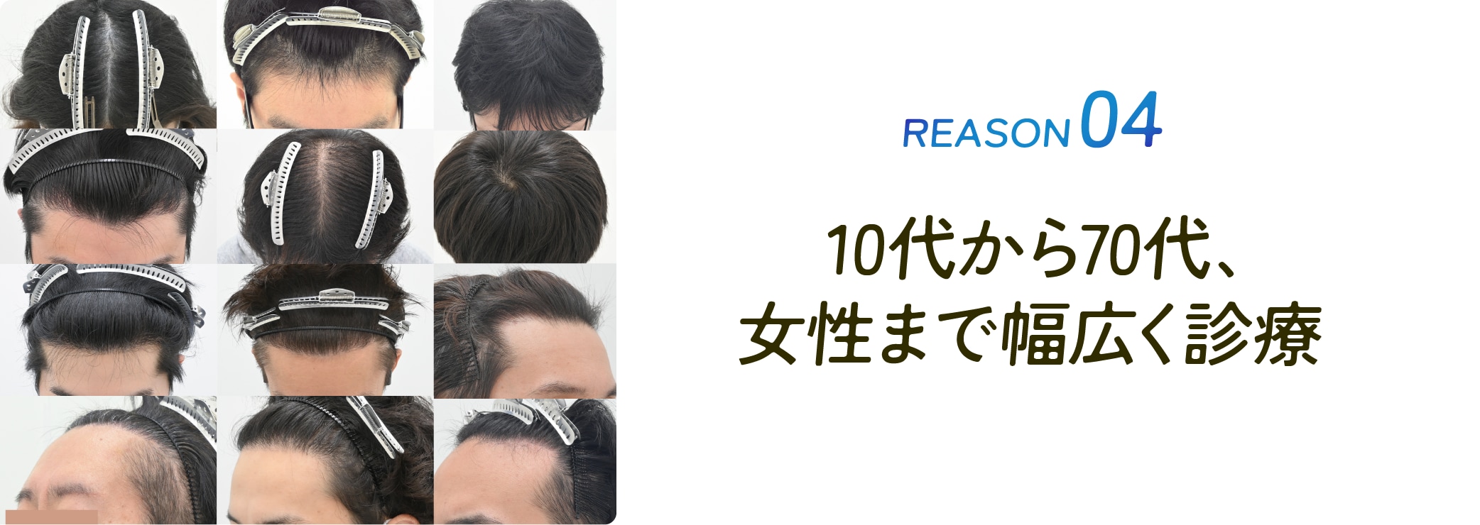 10代から70代、女性まで幅広く診療