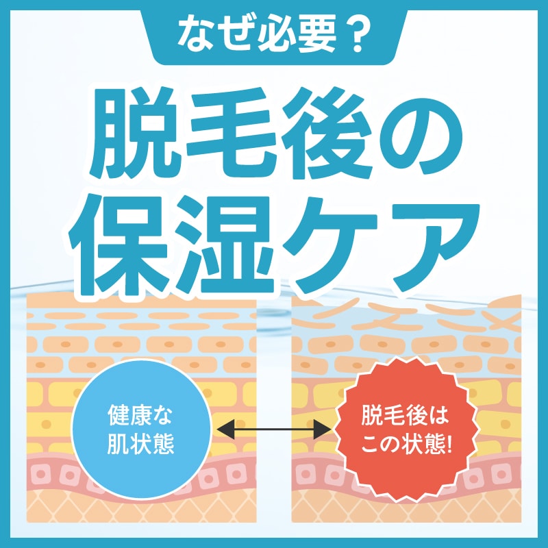 【脱毛後の保湿ケア】なぜ必要？保湿ケアをする理由