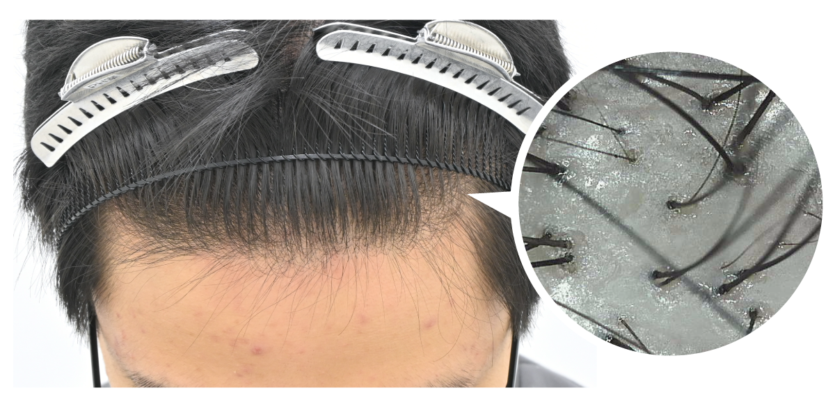 マイクロスコープによる所見の特徴