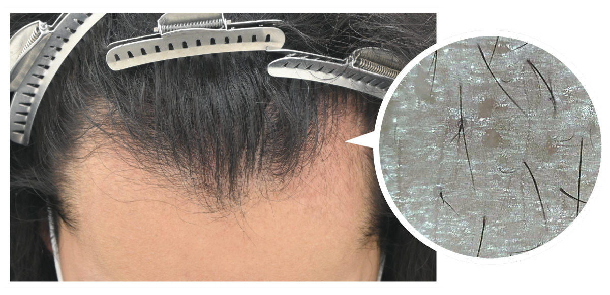 マイクロスコープによる所見の特徴