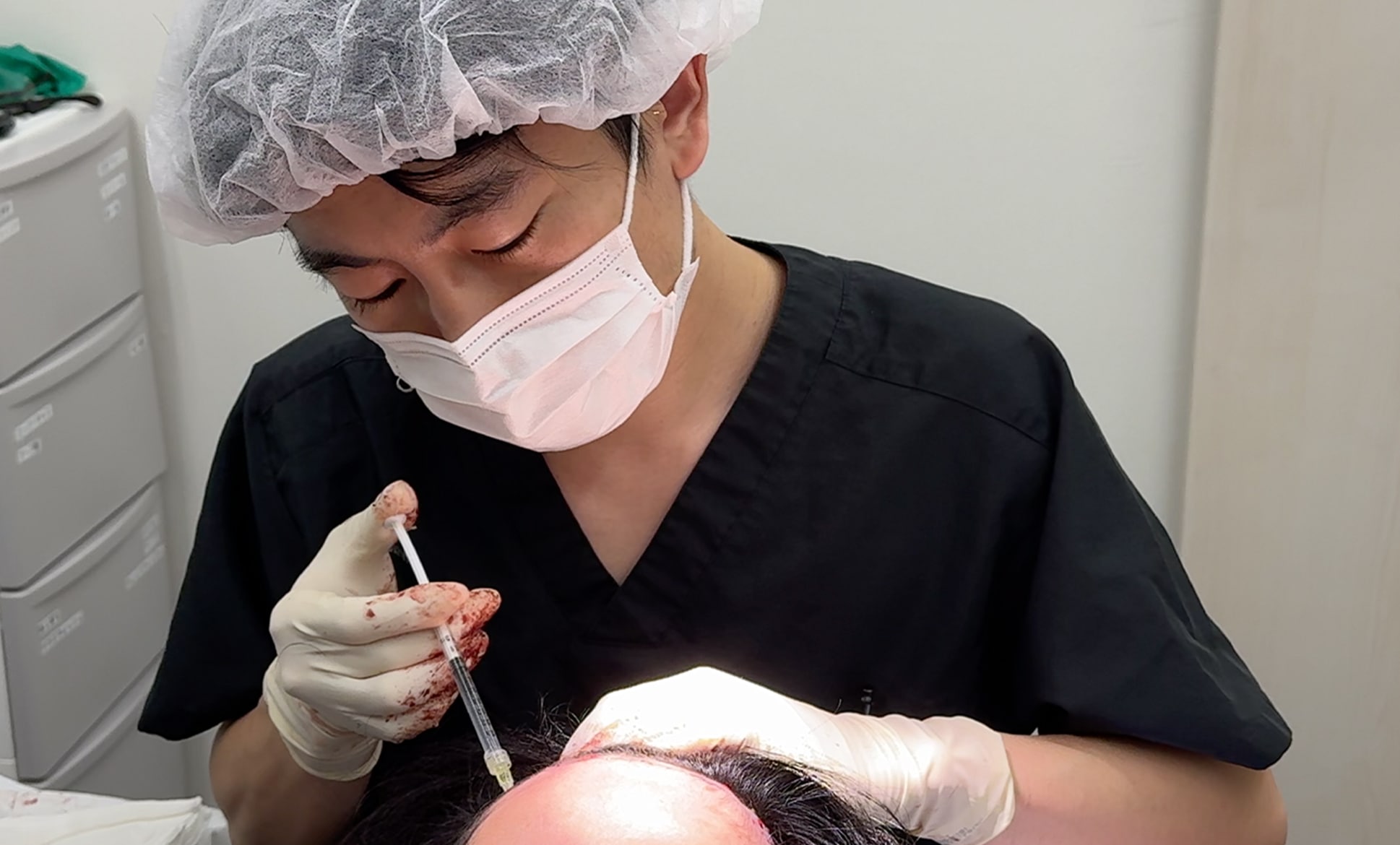 ①豊富な症例経験に基づいた<strong>「注入技術」</strong>