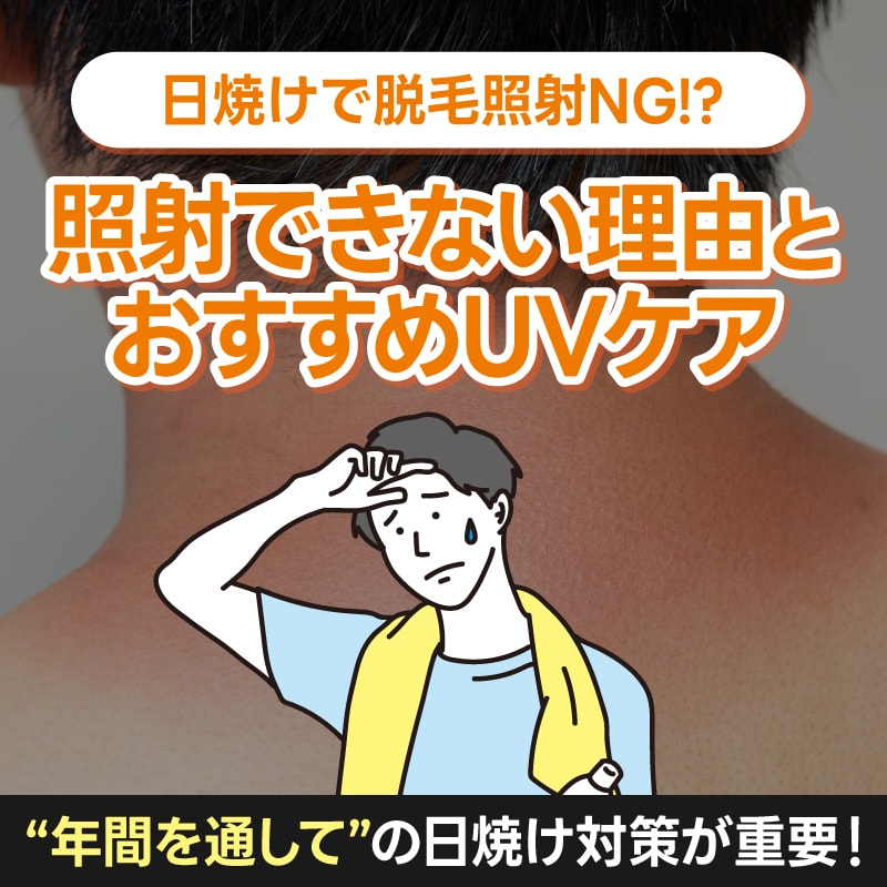 日焼けで脱毛の照射NGに？照射を断られる理由とおすすめUVケアを徹底解説