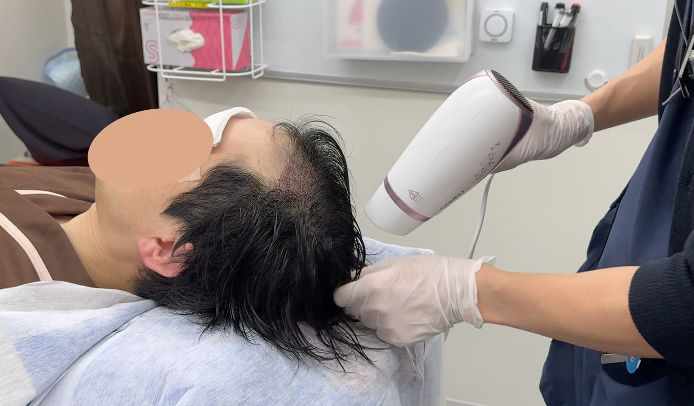 術後ケア