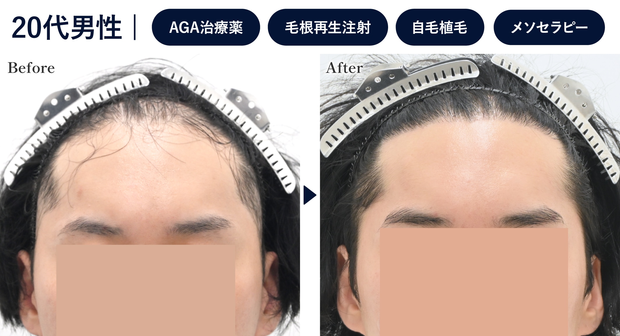 なるべくボリュームを増やしていきたい方