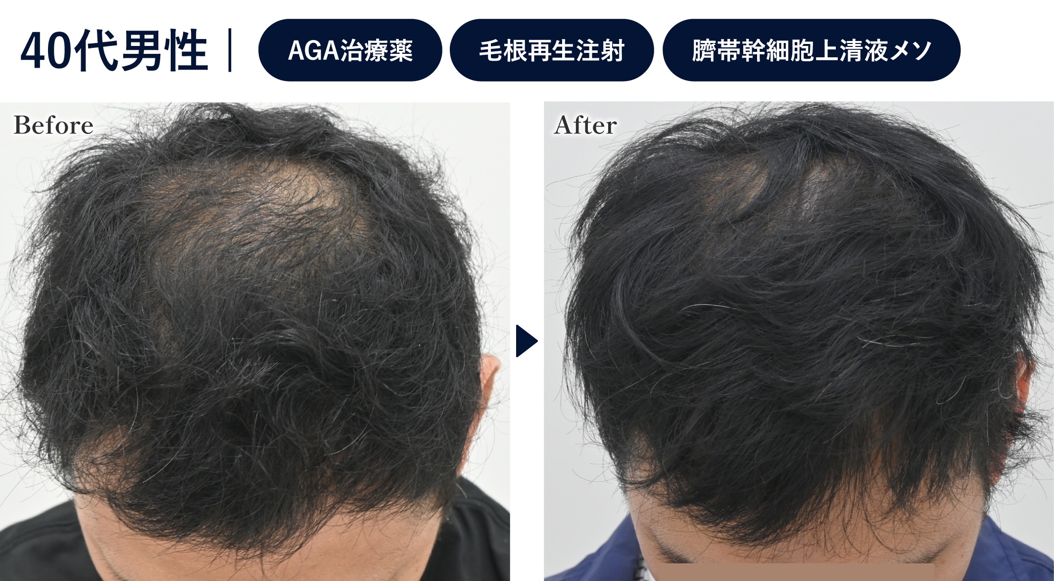 個人輸入薬で思うように改善しなかった方