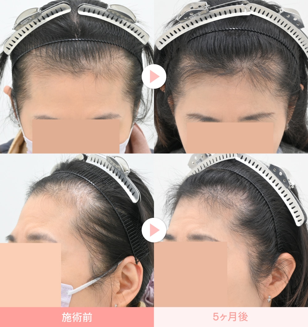症例写真②