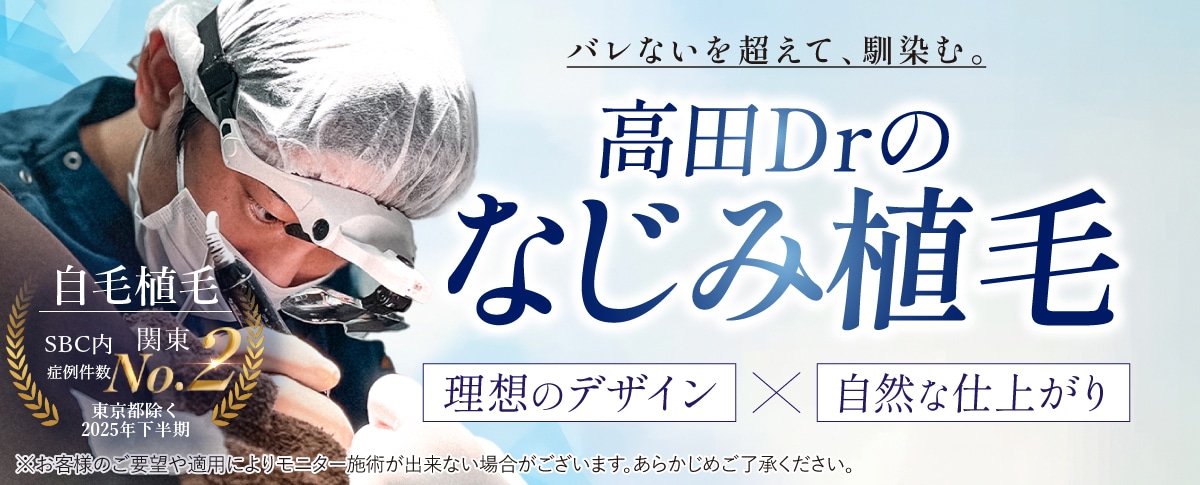 写真あり】自毛植毛「1000株以下」でどこまで変わる？M字や生え際の
