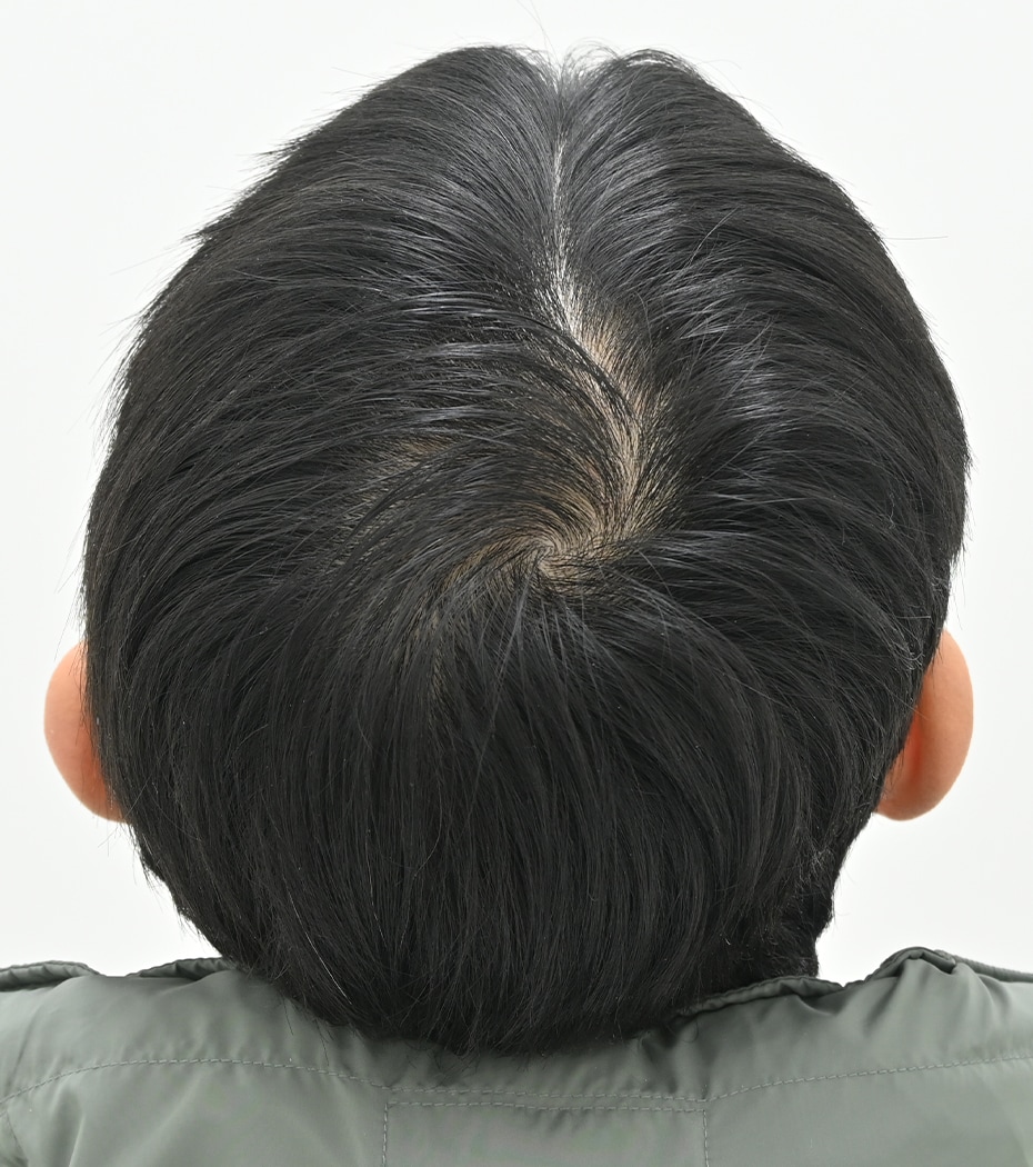 after