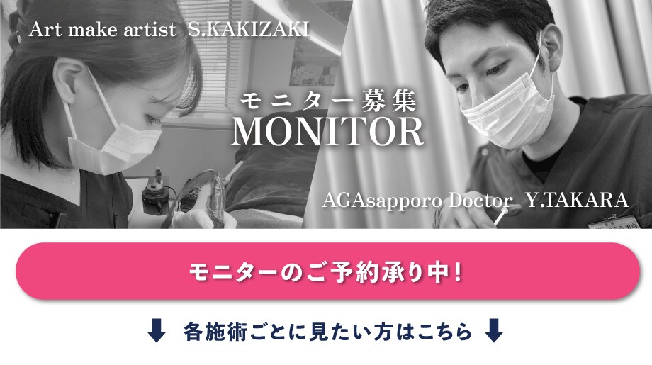 湘南AGAクリニック札幌院のモニター募集