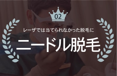 医療脱毛はニードル脱毛の時代に!