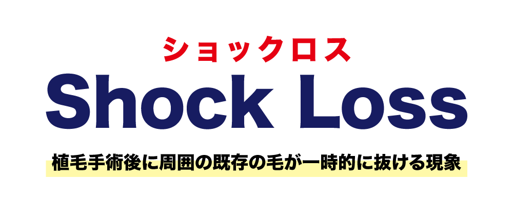 そもそもショックロスとは？