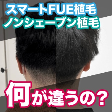 【自毛植毛】スマートFUE植毛とノンシェーブン植毛の違い