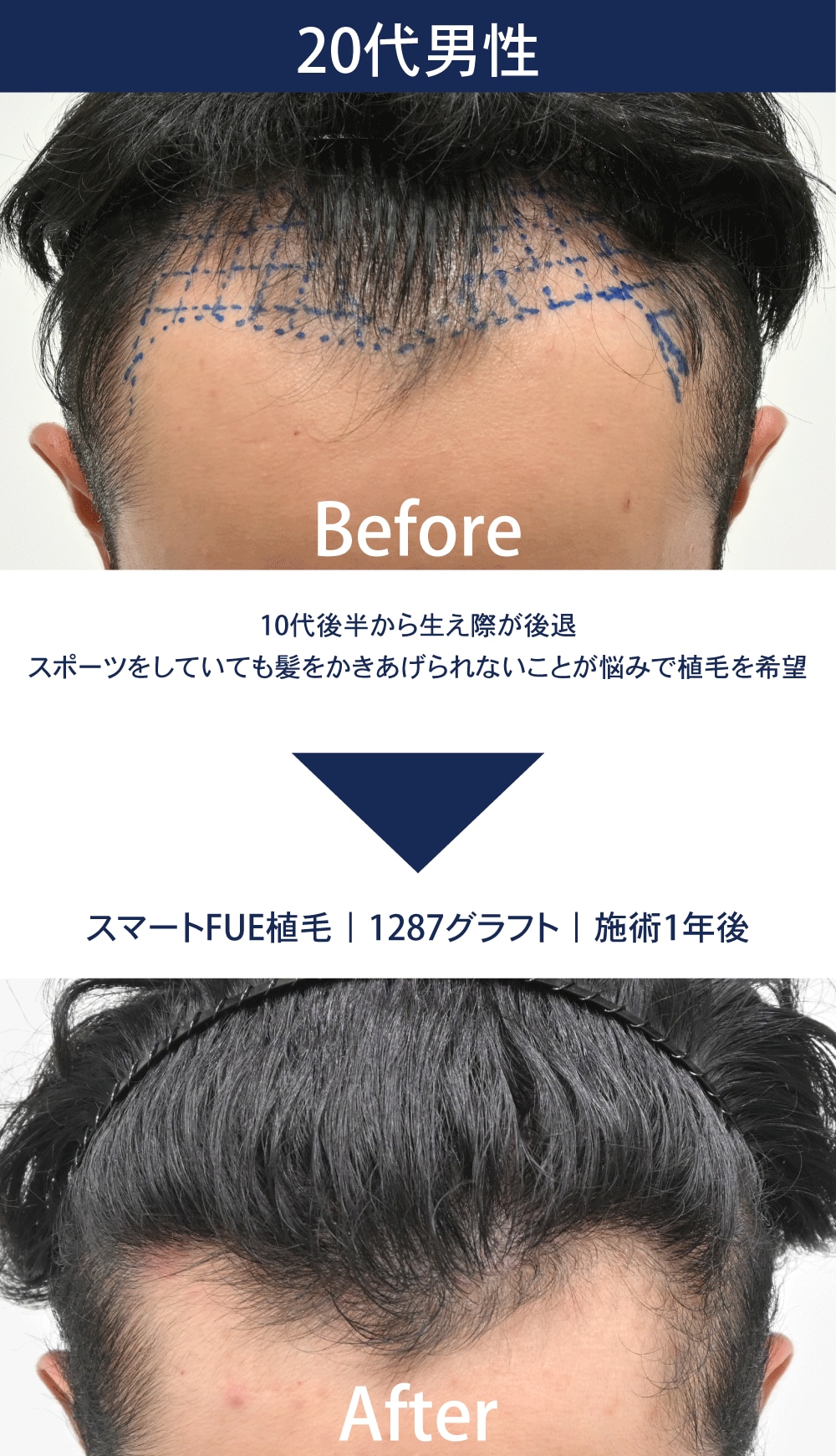 年齢・悩み別に傾向を紹介