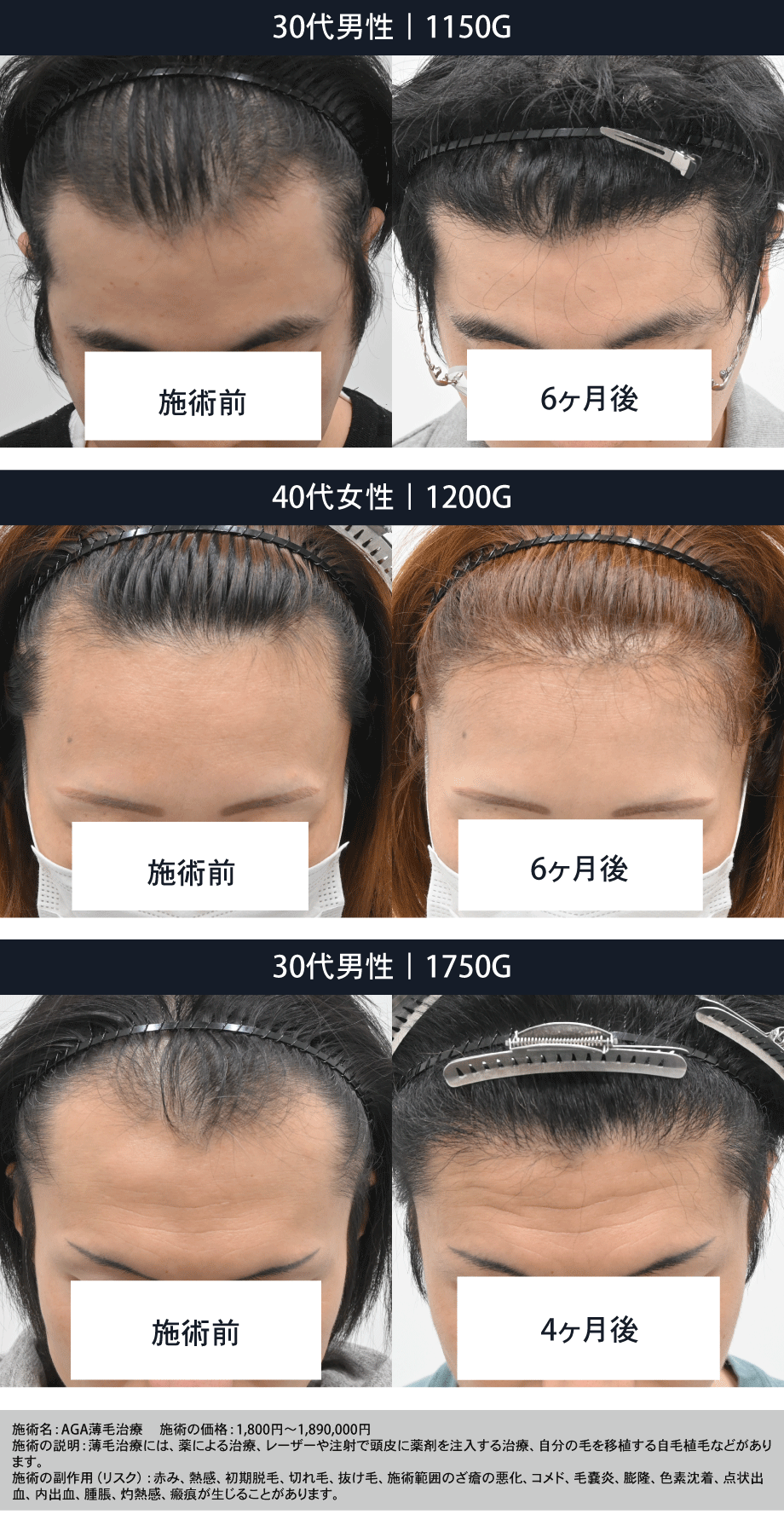 自分のAGA治療のゴールはどこなのか?