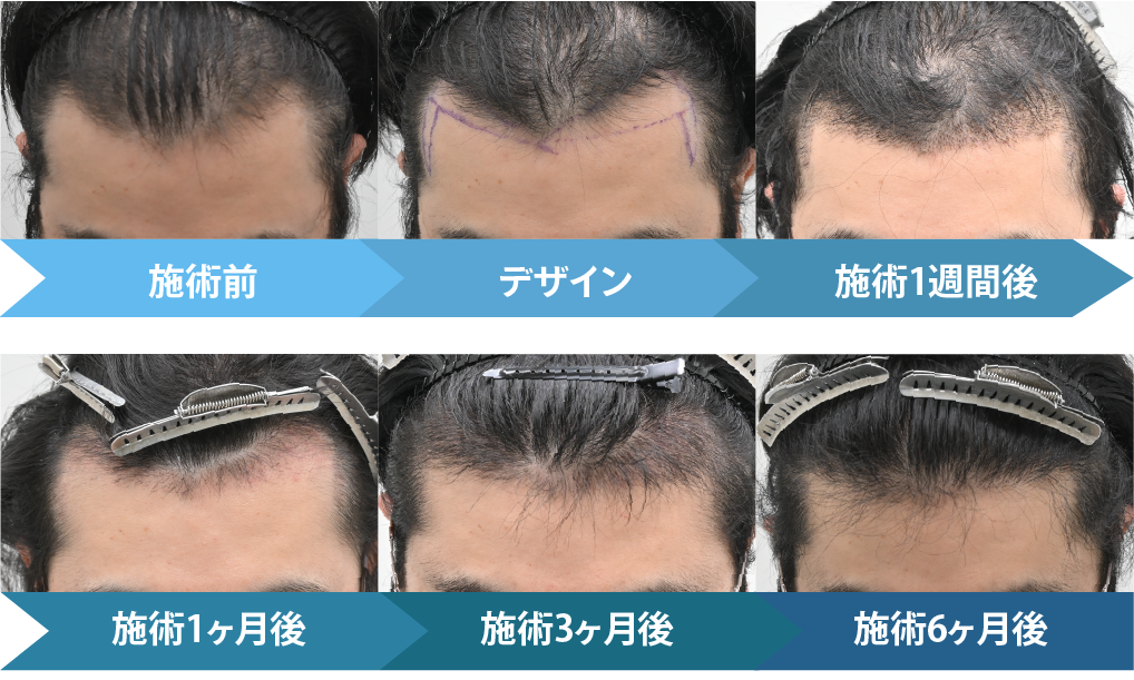 では施術の変化を見ていきます