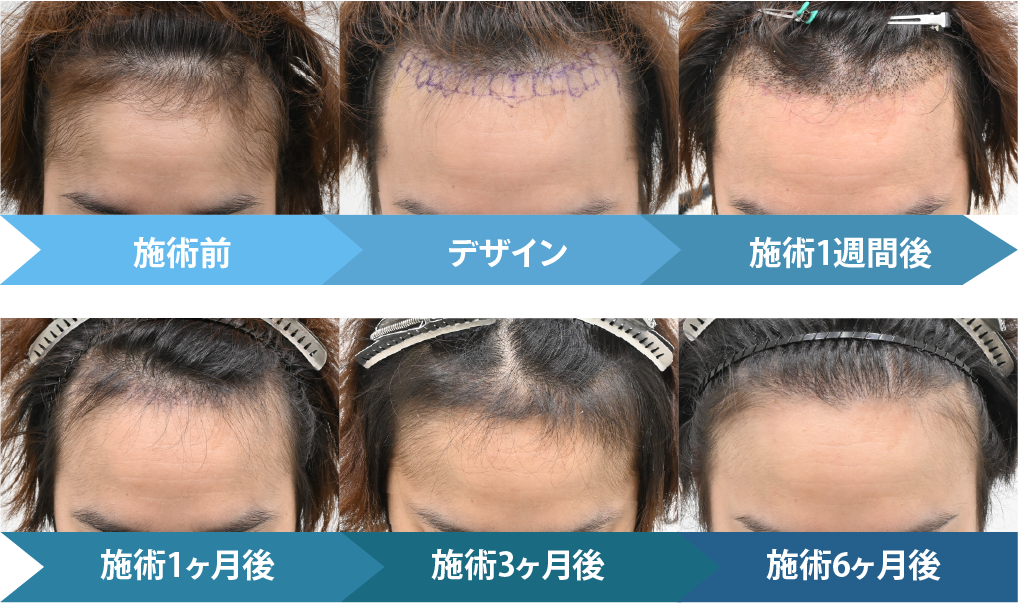 では施術の変化を見ていきます