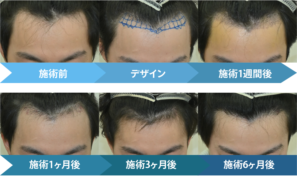 では施術の変化を見ていきます