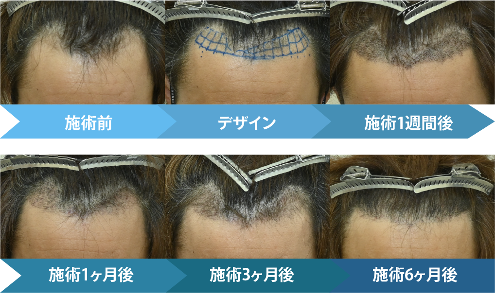 では施術の変化を見ていきます