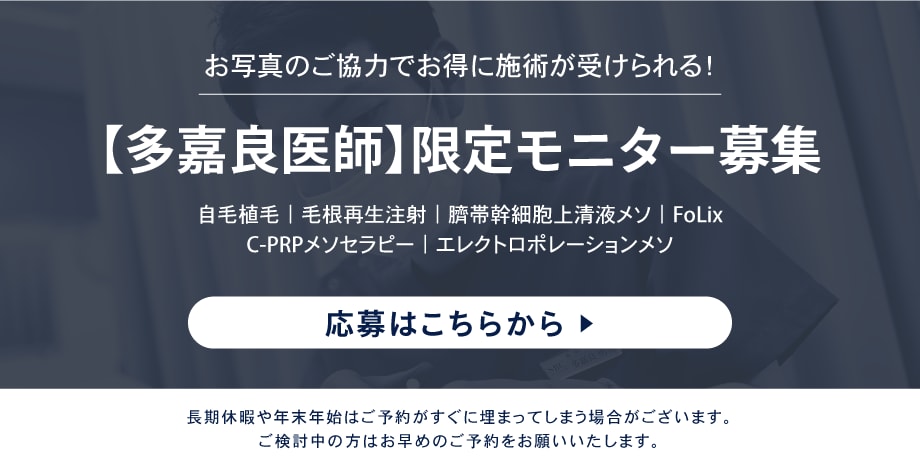 湘南AGAクリニック札幌院のモニター募集