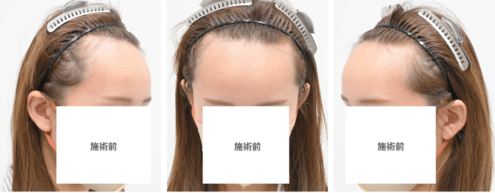 モニター様のご希望と治療内容